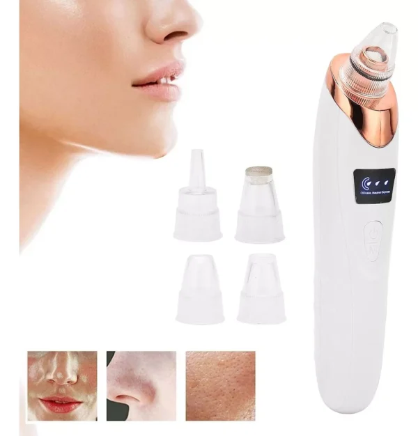 1704731738D_NQ_NP_2X_902338-MLC71587072740_092023-F Removedor de puntos negros