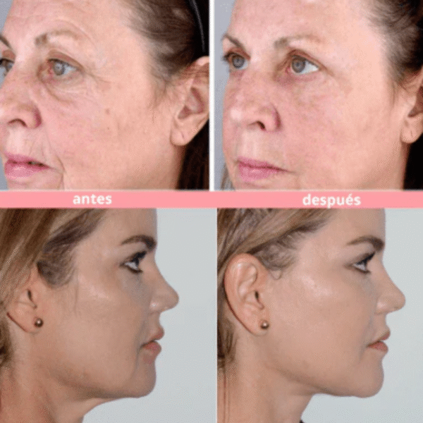 Masajeador Facial USB